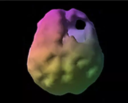 Description of image 2